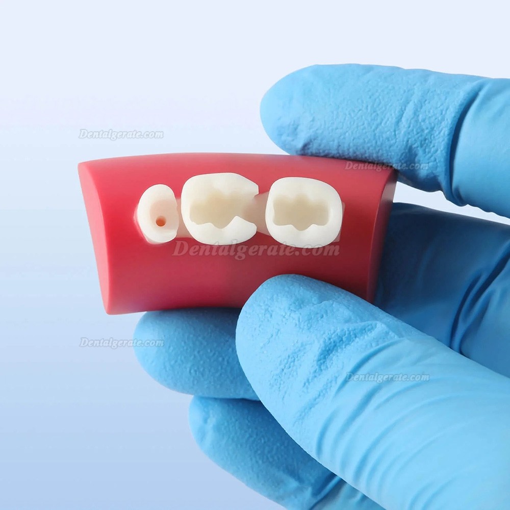 Dental Inlay &Uuml;bungsblock Komposit-Harz F&uuml;llung Z&auml;hne